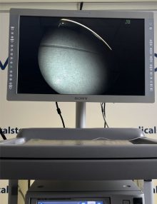 Wieża do kolonoskopii i gastroskopii FUJINON EPX-4450HD